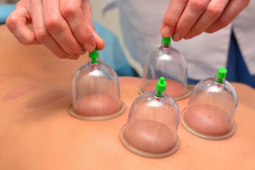 Le cupping: traitement controversé à Rio